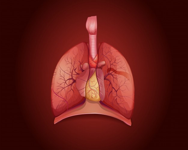 Diagram showing lungs with disease