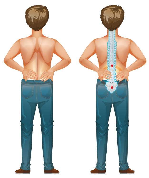 Human male with back pain